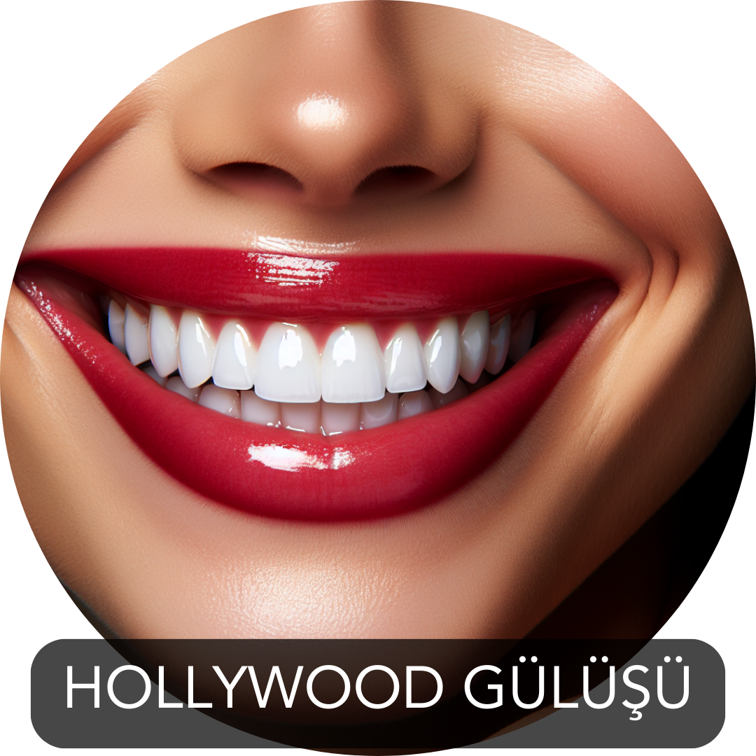 Gülüş tasarımı