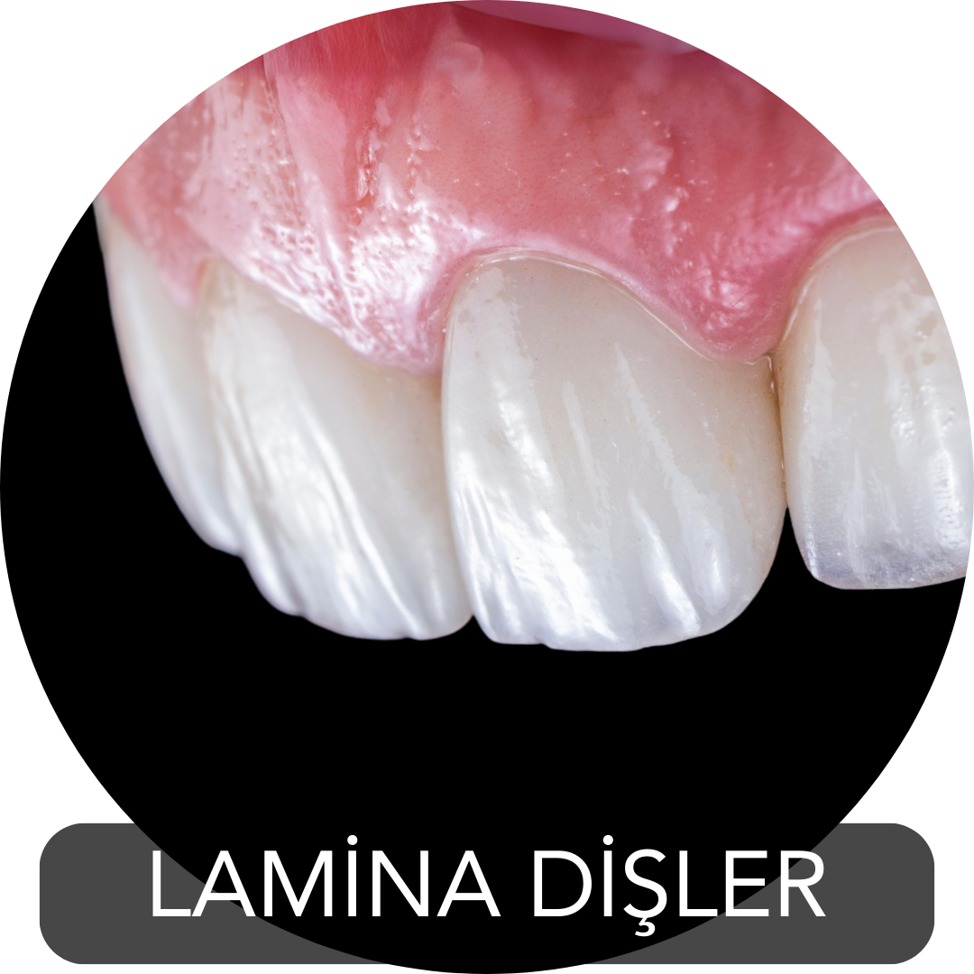 Lamina
